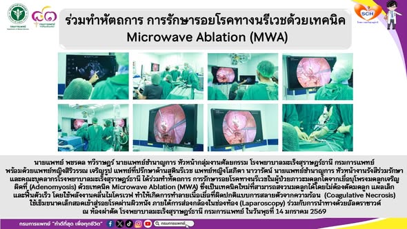 นายแพทย์ พชรดล ทวีราษฎร์ นายแพทย์ชำนาญการ หัวหน้ากลุ่มงานศัลยกรรม โรงพยาบาลมะเร็งสุราษฎร์ธานี กรมการแพทย์
พร้อมด้วยแพทย์หญิงสิริวรรณ เจริญรูป แพทย์ที่ปรึกษาด้านสูตินรีเวช แพทย์หญิงโสภิตา นาวารัตน์ นายแพทย์ชำนาญการ หัวหน้างานรังสีร่วมรักษา และคณะบุคลากรโรงพยาบาลมะเร็งสุราษฎร์ธานี ได้ร่วมทำหัตถการ การรักษารอยโรคทางนรีเวชในผู้ป่วยภาวะมดลูกโตจากเยื่อบุโพรงมดลูกเจริญผิดที่ (Adenomyosis) ด้วยเทคนิค Microwave Ablation (MWA) ซึ่งเป็นเทคนิคใหม่ที่สามารถสงวนมดลูกได้โดยไม่ต้องตัดมดลูก แผลเล็ก และฟื้นตัวเร็ว โดยใช้พลังงานคลื่นไมโครเวฟ ทำให้เกิดการทำลายเนื้อเยื่อที่ผิดปกติแบบการสลายตัวจากความร้อน  (Coagulative Necrosis) ใช้เข็มขนาดเล็กสอดเข้าสู่รอยโรคผ่านผิวหนัง ภายใต้การส่องกล้องในช่องท้อง (Laparoscopy) ร่วมกับการนำทางด้วยอัลตราซาวด์ ณ ห้องผ่าตัด โรงพยาบาลมะเร็งสุราษฎร์ธานี กรมการแพทย์ ในวันพุธที่ 14 มกราคม 2569